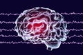 EEG Electroencephalogram, brain wave in awake state with mental activity