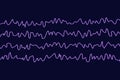 EEG Electroencephalogram, brain wave in awake state during rest