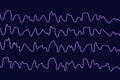 EEG Electroencephalogram, brain wave during sleeping