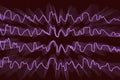 EEG Electroencephalogram, brain wave during sleeping