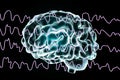 EEG Electroencephalogram, brain wave during sleeping Royalty Free Stock Photo