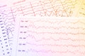 EEG electrophysiological monitoring method. EEG wave in human br Royalty Free Stock Photo