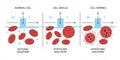 Red cells in isotonic hypotonic and hypertonic solutions Royalty Free Stock Photo