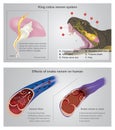 Effect of snake venom on human. Info graphic Illustration. Royalty Free Stock Photo