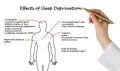 Effects of Sleep Deprivation