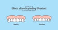 Effects of teeth grinding Bruxism illustration vector on blue