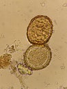 Egg of Ascaris lumbricoides roundworm in human stool