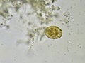 Egg of Ascaris lumbricoides roundworm