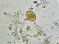 Egg of Ascaris lumbricoides roundworm