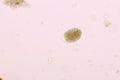 Egg of Hookworm in human stool Royalty Free Stock Photo