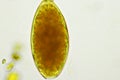 Egg of intestinal fluke in human stool