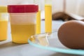 Egg in laboratory infected with Fipronil