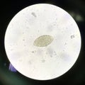 Egg parasite human in stool examination Royalty Free Stock Photo
