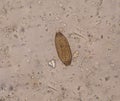 Egg parasite in stool exam Royalty Free Stock Photo