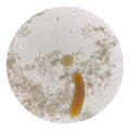 Egg of parasite in stool exam