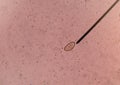 Egg of parasite in stool exam. Royalty Free Stock Photo