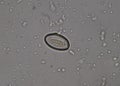 Egg of parasite in stool examition testing