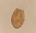 Egg parasite in stool human