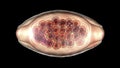 Egg of parasitic roundworm Trichuris trichiura