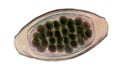 Egg of parasitic roundworm Trichuris trichiura