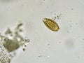 Egg of Trichuris trichiura Royalty Free Stock Photo