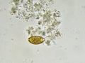 Egg of Trichuris trichiura Royalty Free Stock Photo