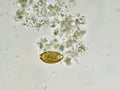 Egg of Trichuris trichiura