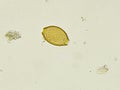 Egg of Trichuris trichiura (whipworm)