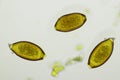 Egg of Trichuris trichiura whipworm in human stool