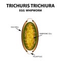 Egg whipworm. Trichuris. Infographics. Vector illustration on isolated background.