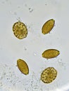 Eggs of helminthes