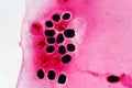 Eggs liver flukeParasitic flatworm infection in fish scale.