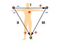 Einthoven ECG triangle, including augmented unipolar limb lead