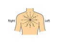 Einthoven ECG triangle, including augmented unipolar limb lead