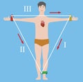 Einthoven's triangle vector illustration Royalty Free Stock Photo