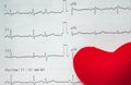 EKG analysis paper showing abnormal EKG of the patients in hospital Royalty Free Stock Photo