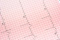 EKG background