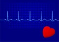 EKG blue