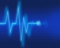 EKG chart Royalty Free Stock Photo