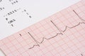 EKG chart Royalty Free Stock Photo