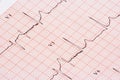 EKG chart Royalty Free Stock Photo