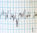 EKG Royalty Free Stock Photo