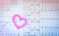 EKG or ECG Electrocardiogram graph report paper. EST Exercise Stress Test result and pink heart shape made from pills. Packa Royalty Free Stock Photo