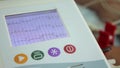 EKG ECG electrocardiography device monitor