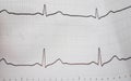 Ekg/ ecg -  medical background in hospital Royalty Free Stock Photo