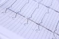 Ekg/ ecg -  medical background in hospital Royalty Free Stock Photo