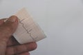 Ekg/ ecg - medical background of the patient in the hand Royalty Free Stock Photo