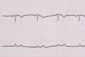 Ekg/ ecg - medical background Royalty Free Stock Photo