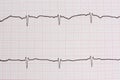 Ekg/ ecg - medical background Royalty Free Stock Photo