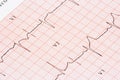 EKG graph Royalty Free Stock Photo